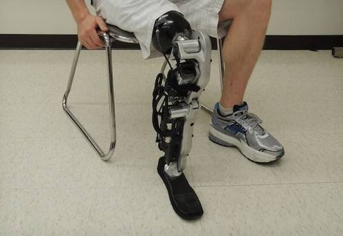 河南假肢:手術(shù)后什么時候安裝假肢好(圖1) 河南假肢:手術(shù)后什么時候安裝假肢好(圖1)